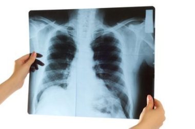 Doctor looking at x-ray image on white Straßenschild Infektionschutz